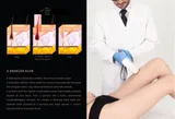 EasyDerm DL2 Dióda lézer szőrtelenítő gép 2