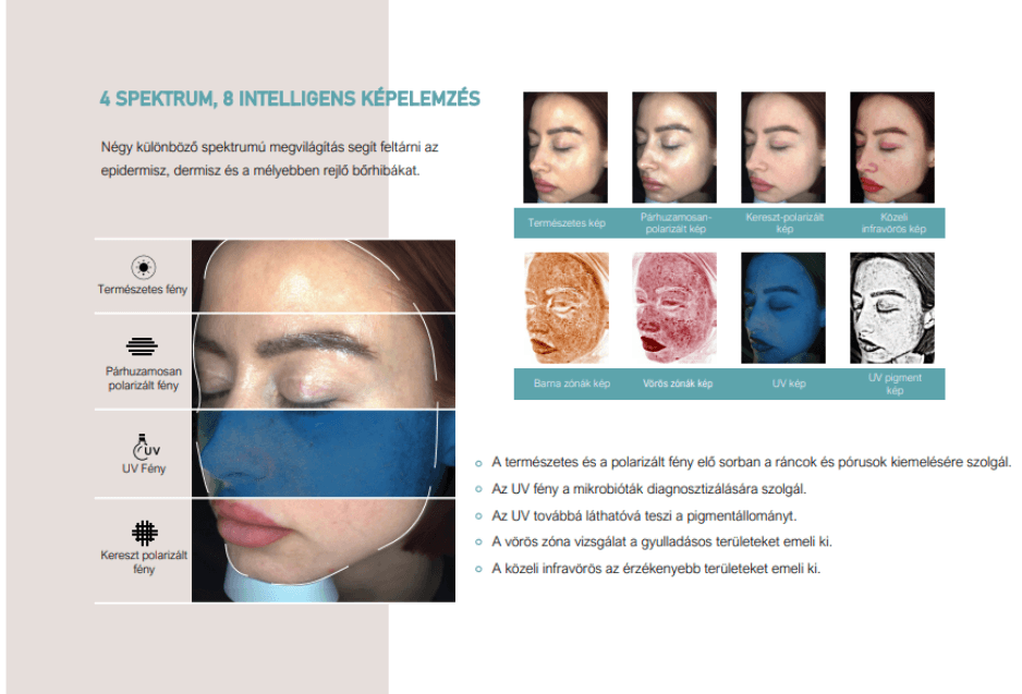 Négy spektrumú arcfotók összehasonlítása a diagnosztikai szoftverben.